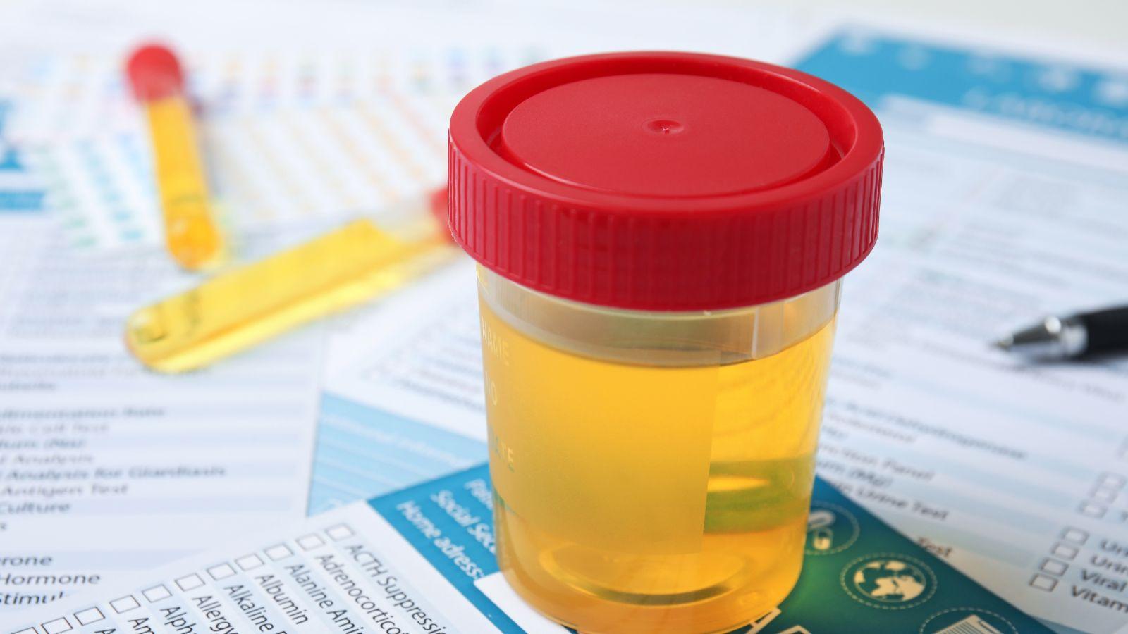 drug testing accountability recovery, sobriety drug testing programs, relapse prevention tools, addiction recovery monitoring, certified drug testing for recovery, location-specific drug testing services, substance abuse monitoring solutions, sobriety accountability methods
